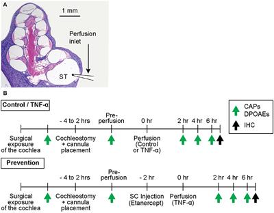 Intracochlear Perfusion of Tumor Necrosis Factor-Alpha Induces Sensorineural Hearing Loss and Synaptic Degeneration in Guinea Pigs